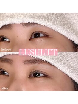 リンド エステ まつげ 京成大久保(Lind)/ラッシュリフト