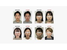 ザ リフト カドモリ 鹿児島 霧島(The Lift KADOMORI)/Before→After