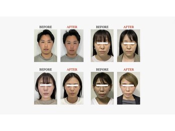 ザ リフト カドモリ 鹿児島 霧島(The Lift KADOMORI)/Before→After