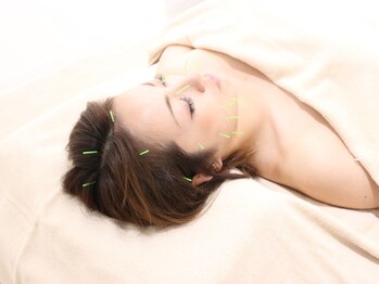 モリタ鍼灸整骨院/スタンダード美容鍼