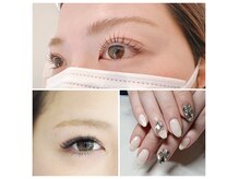 アレーズ(alaise)