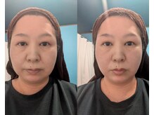 幸縁/小顔コルギ１回