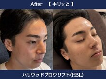 ランドマーク 中崎町(LANDMARK.)/《 ハリウッドブロウリフト 》