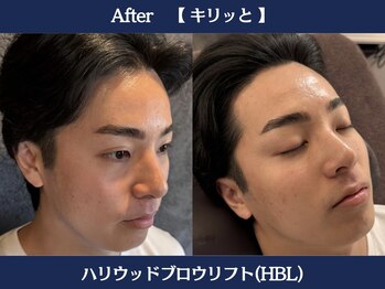 ランドマーク 中崎町(LANDMARK.)/《 ハリウッドブロウリフト 》