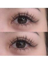 カラン ザ ビューティー(Calin the beauty)/バインドロック