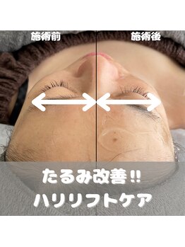 マール(MARL.)/小顔効果抜群!!