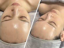 ラグ(LUXU)/ラミピールフェイシャル