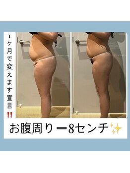 ミユサロン(Miu-salon)/お腹周りマイナス８センチ