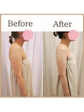 サロンルーチェ(Salon Luce)/ビフォーアフター/施術回数1回