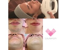 ローランサン(laurencin)