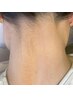 【これからの季節に！】うなじワックス