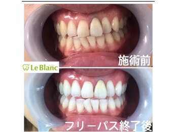 ルブラン 奈良店(Le Blanc)/当店にお任せ下さい!