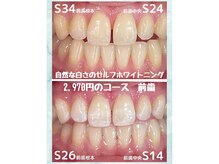 ホワイトニングビューティー 名古屋栄店(WHITENING BEAUTY)