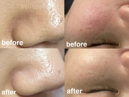 ベルパス(bellepas)の写真