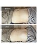 【美body腸刻】上半身かっさ×HOT腸もみ　90分　￥11000