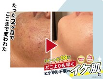 ファスモ(FASMO)