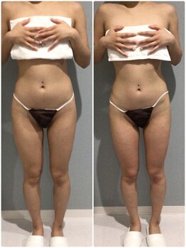 アイ アンド ネイル(Eye＆Nail Day)/痩身コース☆