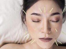 御徒町よつば整骨院/美容鍼