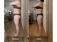 エメ(Aimer)/【20代結果写真☆-11キロ減量】