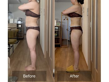 エメ(Aimer)/【20代結果写真☆-11キロ減量】