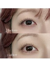 ユリム(yurim)/上下ラッシュリフト