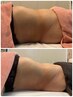 50分寝ているだけでお腹が凹む!資格取得前のモニターお試し価格。同業者様NG