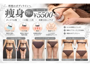 ラクラク(rakuraku)の写真/《脂肪を撃退＆スリムBODY》※結果重視でサイズダウン※理想の身体へ導くエステ体験☆初回70分5500円～