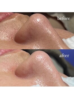 ファウンデーション(FOUNDATION)/たった一回でも綺麗に♪