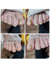 爪切り屋 足楽/1度の爪切りでも