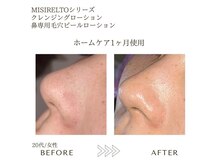 サロンエイトミー 西船橋店(salon 83)/ before→after 1ヶ月後