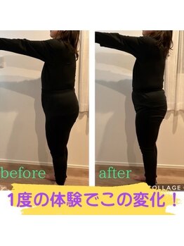 ヨサパーク リープ(YOSA PARK Leap)/プレミアムコースのbefore after