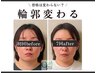 【エラ張り/浮腫】小顔頭蓋骨矯正+高濃度オイル+リンパケア¥9900→¥8400 