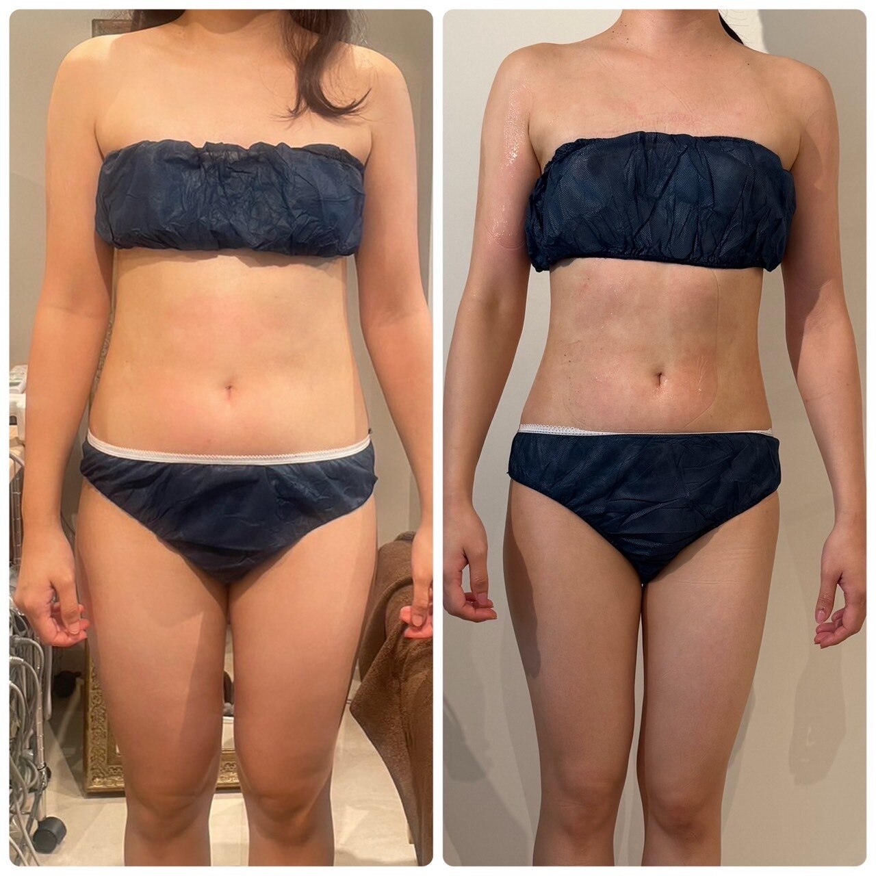 エステビジン 岐阜各務原店(エステBIZIN)｜ホットペッパービューティー