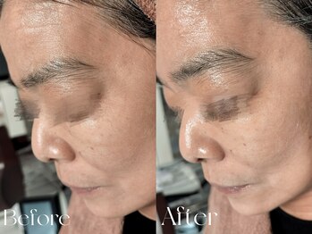 ウィハナ(wehana)/【セラピール】エイジングケア