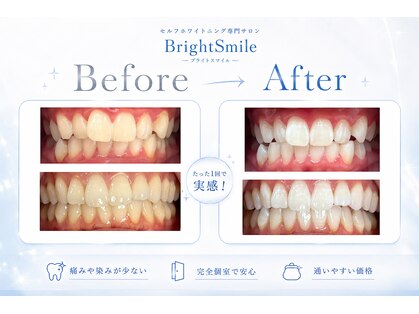 ブライトスマイル 静岡店(Bright Smile)の写真