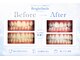 ブライトスマイル 静岡店(Bright Smile)の写真