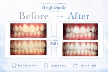 ブライトスマイル 静岡店(Bright Smile)