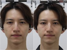 さつま骨格矯正 表参道青山院/歪み小顔矯正＋骨盤矯正