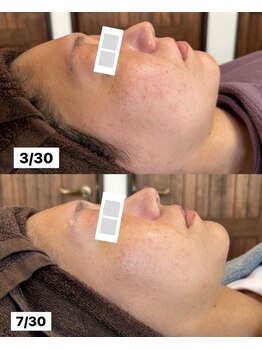 サロン サルー(SALON Salud)/◇再生美容