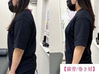ボディメイク アールエフ サクラ接骨院(bodymake RF SAKURA接骨院)/猫背/巻き肩矯正