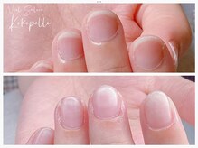 深爪、噛み爪、二枚爪などお爪のなやみをケアから改善