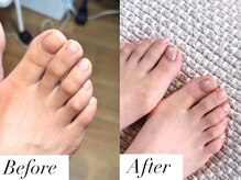 ネイルズ バイ ユイ 外苑前(Nails by Yui)/スペシャルフットケアコース