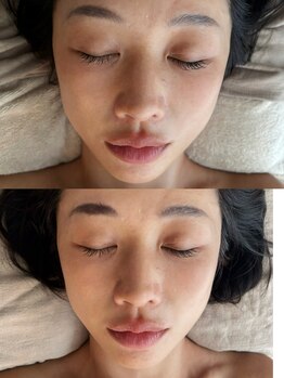 ルシエルリュクス(Le Ciel Luxe)/Before/After