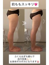 ラナ 京都西院店(Lana)/前もものハリ改善！