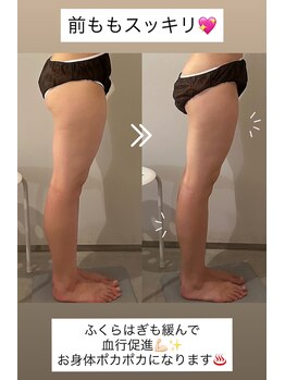 ラナ 京都西院店(Lana)/前もものハリ改善！