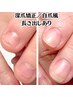 【自爪風長さ出し】こっそり深爪矯正｜爪先強化＋自爪風仕上げ