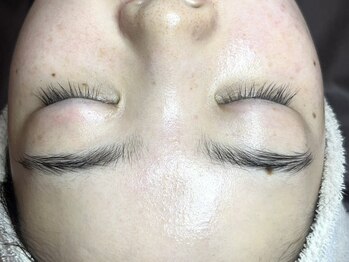 フレーズ(fraise)の写真/乾燥が気になる今の時期でも、話題の【セラピール】で乾燥知らずのみずみずしい水光肌・艶々卵肌に大変身♪