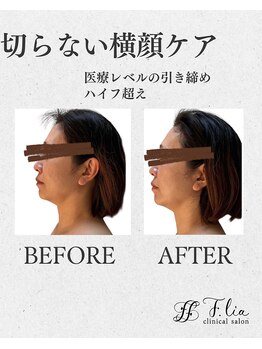 エフリア 大垣(F.lia)/ハ●フ超え!驚きの引き締め効果