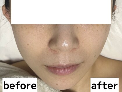 小顔専門店Lift(リフト)新宿西口の写真