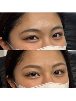 ブリス 姫路(Bliss)/お客様Before/After